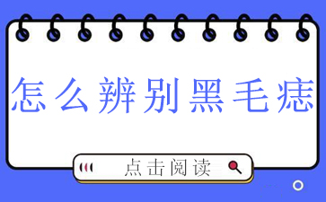 广州看黑毛痣去哪家好啊-怎么辨别黑毛痣
