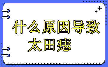 广州太田痣医院-什么原因导致太田痣
