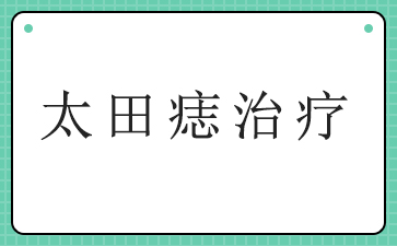 广州治疗胎记医院-太田痣治疗
