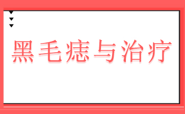 广州去黑毛痣医院-黑毛痣与治疗