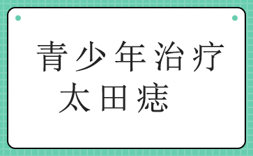 广州去除太田痣多少钱-青少年治疗太田痣