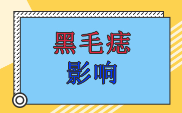 广州黑毛痣治疗医院-黑毛痣影响