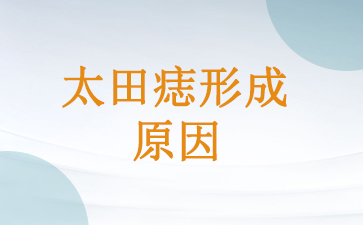 广州去太田痣的医院-太田痣形成原因