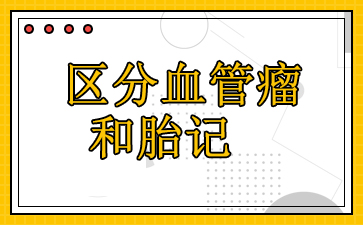 广州治疗血管瘤医院排名-区分血管瘤和胎记