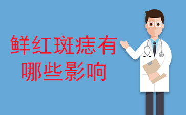 广州看鲜红斑痣好的医院-鲜红斑痣有哪些影响